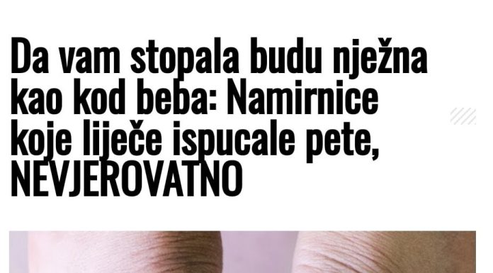 Stopala nježna kao kod beba: Namirnice koje liječe ispucale pete