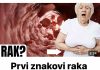 Prvi znakovi raka debelog crijeva koje žene ignoriraju!