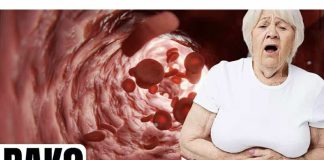 Prvi znakovi raka debelog crijeva koje žene ignoriraju!