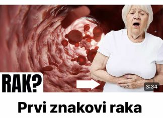 Prvi znakovi raka debelog crijeva koje žene ignoriraju!