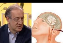 Kardiolog Simić upozorio, OVO JE PRVI ZNAK DA VAM PRIJETI MOŽDANI UDAR: Otkrio kako da se zaštite na vrijeme
