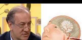 Kardiolog Simić upozorio, OVO JE PRVI ZNAK DA VAM PRIJETI MOŽDANI UDAR: Otkrio kako da se zaštite na vrijeme