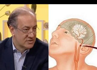 Kardiolog Simić upozorio, OVO JE PRVI ZNAK DA VAM PRIJETI MOŽDANI UDAR: Otkrio kako da se zaštite na vrijeme