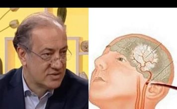 Kardiolog Simić upozorio, OVO JE PRVI ZNAK DA VAM PRIJETI MOŽDANI UDAR: Otkrio kako da se zaštite na vrijeme
