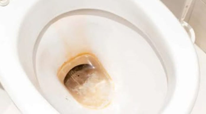 Odličan KUĆNI TRIK kako ukloniti žute mrlje i kamenac u WC šolji bez hemikalija: Testirano, djeluje odmah!