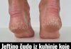 Jeftino čudo iz kuhinje koje spašava vaša stopala: Kao rukom rješava ispucale peta, gljivice i kurje oči