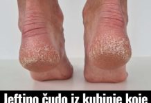 Jeftino čudo iz kuhinje koje spašava vaša stopala: Kao rukom rješava ispucale peta, gljivice i kurje oči