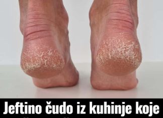 Jeftino čudo iz kuhinje koje spašava vaša stopala: Kao rukom rješava ispucale peta, gljivice i kurje oči