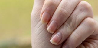 I nokti na nogama mogu da otkriju bolest: Ako PRIMIJETITE ove promene, moguće je da vas je napao „tihi ubica“