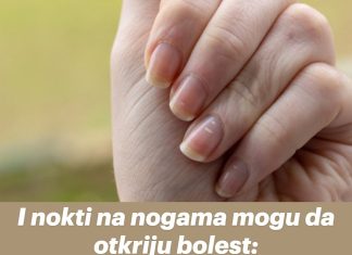 I nokti na nogama mogu da otkriju bolest: Ako PRIMIJETITE ove promene, moguće je da vas je napao „tihi ubica“