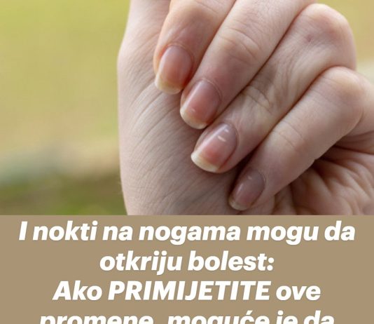 I nokti na nogama mogu da otkriju bolest: Ako PRIMIJETITE ove promene, moguće je da vas je napao „tihi ubica“