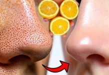 12 ČUDESNIH BEAUTY MOĆI LIMUNA 🍋 – Prirodni recepti za savršeno blistavu kožu 12 ČUDESNIH BEAUTY MOĆI LIMUNA 🍋 – Prirodni recepti za savršeno blistavu kožu - featured image