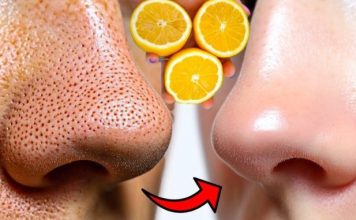12 ČUDESNIH BEAUTY MOĆI LIMUNA 🍋 – Prirodni recepti za savršeno blistavu kožu 12 ČUDESNIH BEAUTY MOĆI LIMUNA 🍋 – Prirodni recepti za savršeno blistavu kožu - featured image