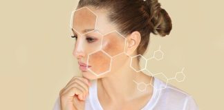 Imate tamne mrlje na licu i rukama? Evo kako ih se riješiti Imate tamne mrlje na licu i rukama? Evo kako ih se riješiti - featured image