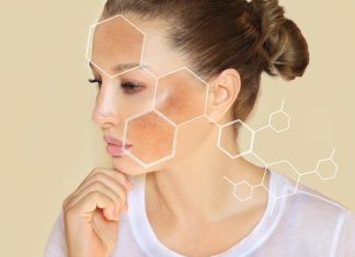 Imate tamne mrlje na licu i rukama? Evo kako ih se riješiti Imate tamne mrlje na licu i rukama? Evo kako ih se riješiti - featured image