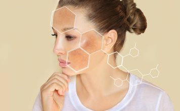 Imate tamne mrlje na licu i rukama? Evo kako ih se riješiti Imate tamne mrlje na licu i rukama? Evo kako ih se riješiti - featured image