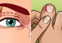 VISOK HOLESTEROL JE TIHI UBICA ČIJE SIMPTOME IGNORIŠE 96% LJUDI. Ovi simptomi će vam spasiti život. br. 4 je posljednje upozorenje VISOK HOLESTEROL JE TIHI UBICA ČIJE SIMPTOME IGNORIŠE 96% LJUDI. Ovi simptomi će vam spasiti život. br. 4 je posljednje upozorenje - featured image