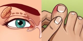 VISOK HOLESTEROL JE TIHI UBICA ČIJE SIMPTOME IGNORIŠE 96% LJUDI. Ovi simptomi će vam spasiti život. br. 4 je posljednje upozorenje VISOK HOLESTEROL JE TIHI UBICA ČIJE SIMPTOME IGNORIŠE 96% LJUDI. Ovi simptomi će vam spasiti život. br. 4 je posljednje upozorenje - featured image