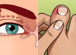 VISOK HOLESTEROL JE TIHI UBICA ČIJE SIMPTOME IGNORIŠE 96% LJUDI. Ovi simptomi će vam spasiti život. br. 4 je posljednje upozorenje VISOK HOLESTEROL JE TIHI UBICA ČIJE SIMPTOME IGNORIŠE 96% LJUDI. Ovi simptomi će vam spasiti život. br. 4 je posljednje upozorenje - featured image