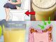 7 blagih noćnih navika za podršku lakšem i zdravijem debelom crijevu 7 blagih noćnih navika za podršku lakšem i zdravijem debelom crijevu - featured image