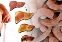 DORUČAK ZA OPORAVAK JETRE: Jede se 2 puta sedmično, obnavlja svaku ćeliju u tijelu! (RECEPT) DORUČAK ZA OPORAVAK JETRE: Jede se 2 puta sedmično, obnavlja svaku ćeliju u tijelu! (RECEPT) - featured image