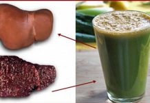 KADA JE JETRA PUNA TOKSINA I VI SE DEBLJATE: Sa ovim napitkom OČISTITE JETRU u potpunosti ZA 72 SATA! KADA JE JETRA PUNA TOKSINA I VI SE DEBLJATE: Sa ovim napitkom OČISTITE JETRU u potpunosti ZA 72 SATA! - featured image