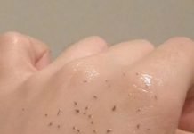 MITISERI SAMI ISPADAJU IZ PORA, ŽENA POKAZALA GENIJALAN TRIK: Uradite ove 3 stvari i oduševit ćete se licem, “SLIKE NISU ZA ONE SA SLABIM SRCEM” MITISERI SAMI ISPADAJU IZ PORA, ŽENA POKAZALA GENIJALAN TRIK: Uradite ove 3 stvari i oduševit ćete se licem, "SLIKE NISU ZA ONE SA SLABIM SRCEM" - featured image