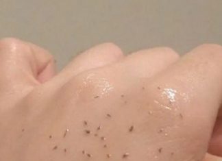 MITISERI SAMI ISPADAJU IZ PORA, ŽENA POKAZALA GENIJALAN TRIK: Uradite ove 3 stvari i oduševit ćete se licem, “SLIKE NISU ZA ONE SA SLABIM SRCEM” MITISERI SAMI ISPADAJU IZ PORA, ŽENA POKAZALA GENIJALAN TRIK: Uradite ove 3 stvari i oduševit ćete se licem, "SLIKE NISU ZA ONE SA SLABIM SRCEM" - featured image