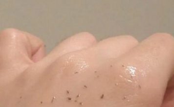 MITISERI SAMI ISPADAJU IZ PORA, ŽENA POKAZALA GENIJALAN TRIK: Uradite ove 3 stvari i oduševit ćete se licem, “SLIKE NISU ZA ONE SA SLABIM SRCEM” MITISERI SAMI ISPADAJU IZ PORA, ŽENA POKAZALA GENIJALAN TRIK: Uradite ove 3 stvari i oduševit ćete se licem, "SLIKE NISU ZA ONE SA SLABIM SRCEM" - featured image