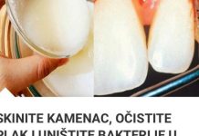 SKINITE KAMENAC, OČISTITE PLAK I UNIŠTITE BAKTERIJE U USTIMA SA SAMO JEDNIM SASTOJKOM SKINITE KAMENAC, OČISTITE PLAK I UNIŠTITE BAKTERIJE U USTIMA SA SAMO JEDNIM SASTOJKOM - featured image