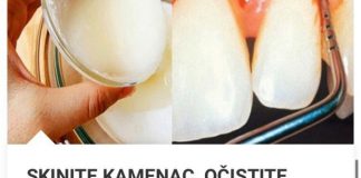 SKINITE KAMENAC, OČISTITE PLAK I UNIŠTITE BAKTERIJE U USTIMA SA SAMO JEDNIM SASTOJKOM SKINITE KAMENAC, OČISTITE PLAK I UNIŠTITE BAKTERIJE U USTIMA SA SAMO JEDNIM SASTOJKOM - featured image