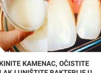 SKINITE KAMENAC, OČISTITE PLAK I UNIŠTITE BAKTERIJE U USTIMA SA SAMO JEDNIM SASTOJKOM SKINITE KAMENAC, OČISTITE PLAK I UNIŠTITE BAKTERIJE U USTIMA SA SAMO JEDNIM SASTOJKOM - featured image