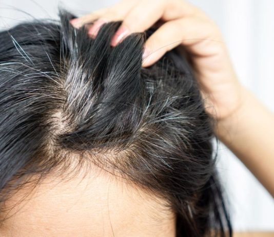 Prekrijte sijede bez farbanja: Jedan sastojak iz kuhinje ima fantastičan efekat Prekrijte sijede bez farbanja: Jedan sastojak iz kuhinje ima fantastičan efekat - featured image