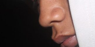 ZVUČI ČUDNO, ALI JE ISTINITO: Evo šta OBLIK NOSA govori O VAMA! Svima je pogodilo ZVUČI ČUDNO, ALI JE ISTINITO: Evo šta OBLIK NOSA govori O VAMA! Svima je pogodilo - featured image