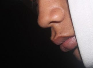 ZVUČI ČUDNO, ALI JE ISTINITO: Evo šta OBLIK NOSA govori O VAMA! Svima je pogodilo ZVUČI ČUDNO, ALI JE ISTINITO: Evo šta OBLIK NOSA govori O VAMA! Svima je pogodilo - featured image