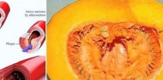 DOKTORI PREDLAŽU: Koristeći ovaj recept recite ZBOGOM povišenom holesterolu, šećeru u krvi, masnoćama i trigliceridima! DOKTORI PREDLAŽU: Koristeći ovaj recept recite ZBOGOM povišenom holesterolu, šećeru u krvi, masnoćama i trigliceridima! - featured image