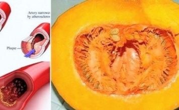 DOKTORI PREDLAŽU: Koristeći ovaj recept recite ZBOGOM povišenom holesterolu, šećeru u krvi, masnoćama i trigliceridima! DOKTORI PREDLAŽU: Koristeći ovaj recept recite ZBOGOM povišenom holesterolu, šećeru u krvi, masnoćama i trigliceridima! - featured image