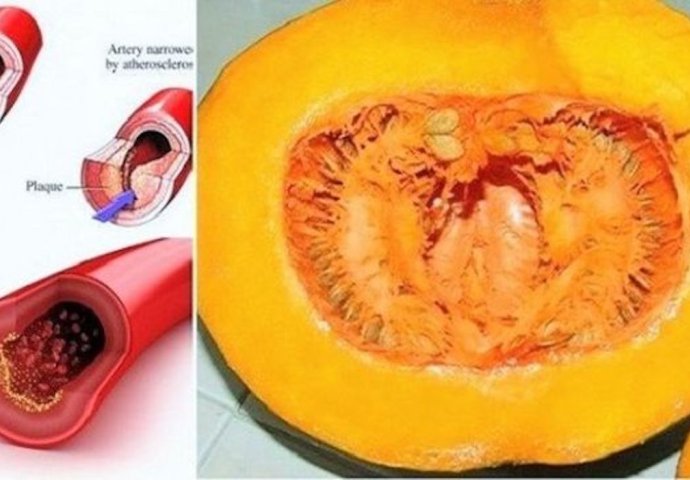 DOKTORI PREDLAŽU: Koristeći ovaj recept recite ZBOGOM povišenom holesterolu, šećeru u krvi, masnoćama i trigliceridima! - featured image DOKTORI PREDLAŽU: Koristeći ovaj recept recite ZBOGOM povišenom holesterolu, šećeru u krvi, masnoćama i trigliceridima! - featured image