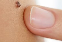 Iz mladeža vam rastu dlačice? Evo što to znači i kada biti na oprezu Iz mladeža vam rastu dlačice? Evo što to znači i kada biti na oprezu - featured image