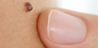 Iz mladeža vam rastu dlačice? Evo što to znači i kada biti na oprezu Iz mladeža vam rastu dlačice? Evo što to znači i kada biti na oprezu - featured image