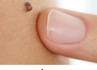 Iz mladeža vam rastu dlačice? Evo što to znači i kada biti na oprezu Iz mladeža vam rastu dlačice? Evo što to znači i kada biti na oprezu - featured image