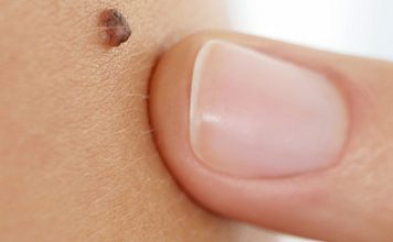 Iz mladeža vam rastu dlačice? Evo što to znači i kada biti na oprezu Iz mladeža vam rastu dlačice? Evo što to znači i kada biti na oprezu - featured image