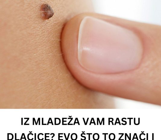 Iz mladeža vam rastu dlačice? Evo što to znači i kada biti na oprezu Iz mladeža vam rastu dlačice? Evo što to znači i kada biti na oprezu - featured image
