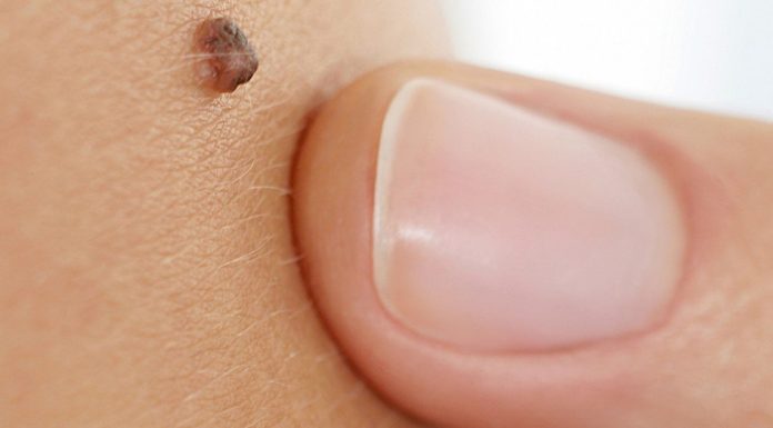 Iz mladeža vam rastu dlačice? Evo što to znači i kada biti na oprezu Iz mladeža vam rastu dlačice? Evo što to znači i kada biti na oprezu - featured image