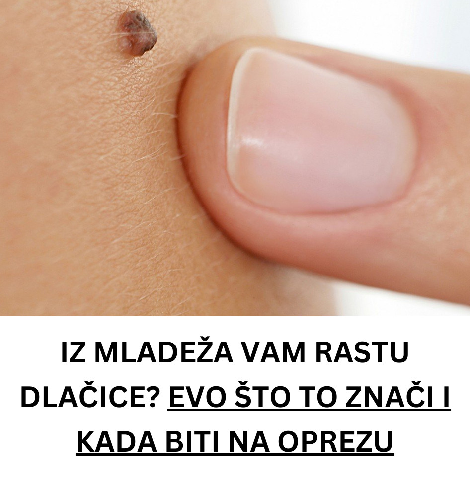Iz mladeža vam rastu dlačice? Evo što to znači i kada biti na oprezu - featured image Iz mladeža vam rastu dlačice? Evo što to znači i kada biti na oprezu - featured image