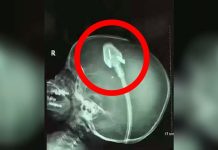 Dječakov rendgen je šokirao doktore diljem svijeta: Sad njegovi roditelji upozoravaju druge! (VIDEO) Dječakov rendgen je šokirao doktore diljem svijeta: Sad njegovi roditelji upozoravaju druge! (VIDEO) - featured image