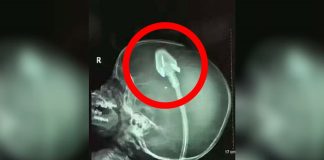 Dječakov rendgen je šokirao doktore diljem svijeta: Sad njegovi roditelji upozoravaju druge! (VIDEO) Dječakov rendgen je šokirao doktore diljem svijeta: Sad njegovi roditelji upozoravaju druge! (VIDEO) - featured image