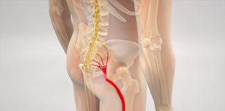 RUSKI METOD UBLAŽAVANJA BOL USLED IŠIJASA: Kupka koja smanjuje napetost mišića RUSKI METOD UBLAŽAVANJA BOL USLED IŠIJASA: Kupka koja smanjuje napetost mišića - featured image