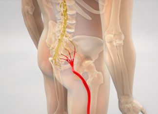 RUSKI METOD UBLAŽAVANJA BOL USLED IŠIJASA: Kupka koja smanjuje napetost mišića RUSKI METOD UBLAŽAVANJA BOL USLED IŠIJASA: Kupka koja smanjuje napetost mišića - featured image