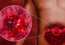 Opasni virus počeo da se širi prije praznika: Ovo su simptomi! Opasni virus počeo da se širi prije praznika: Ovo su simptomi! - featured image